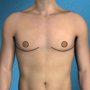Best Way to Get a Square Chest: The Masculinized Chest.