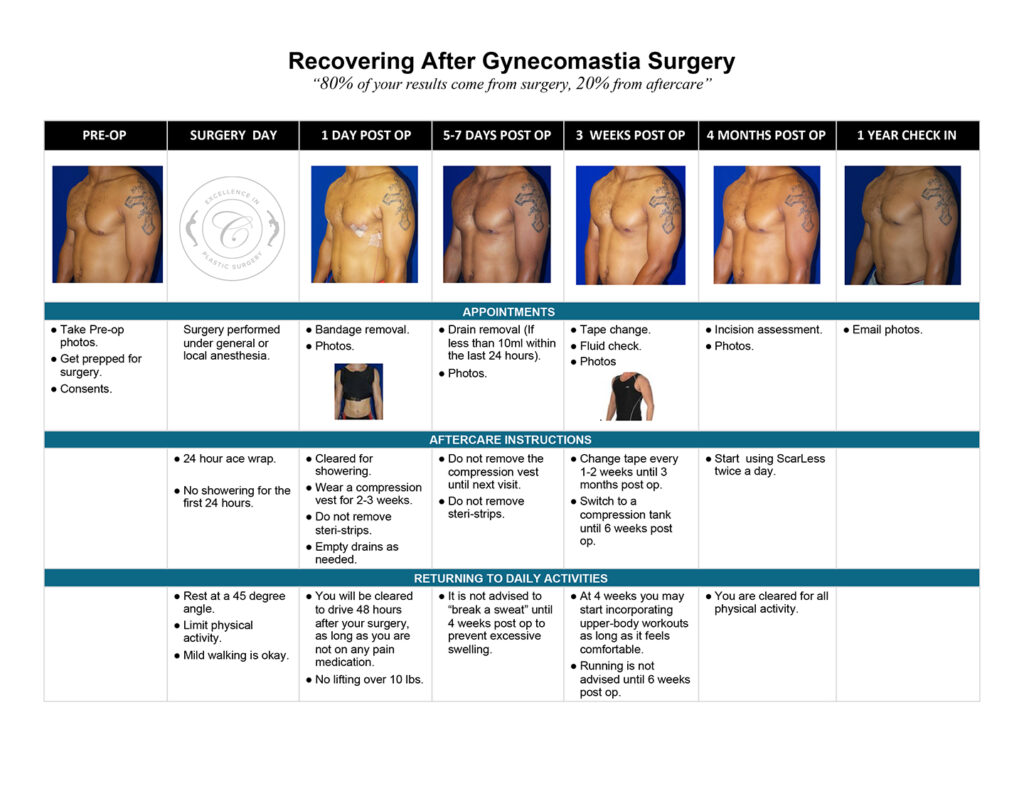 Gynecomastia Healing Side Effects
