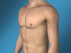 https://lagynecomastia.org/wp-content/uploads/2023/03/gynecomastia-ideal-chest-oblique-1.jpg